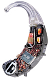 digital hearing aid